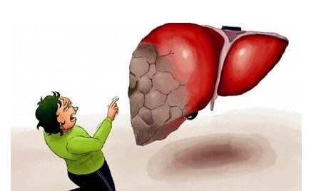 頭部出現(xiàn)這4種狀況，就要注意你的肝了！